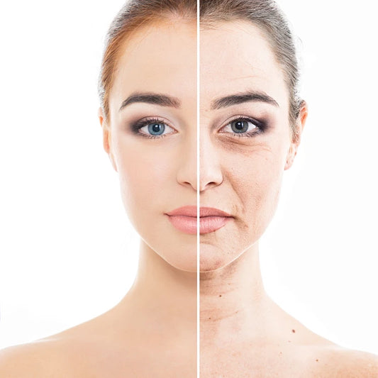 Radiofrequency Through Microneedles for Tightening Facial Skin and Pores