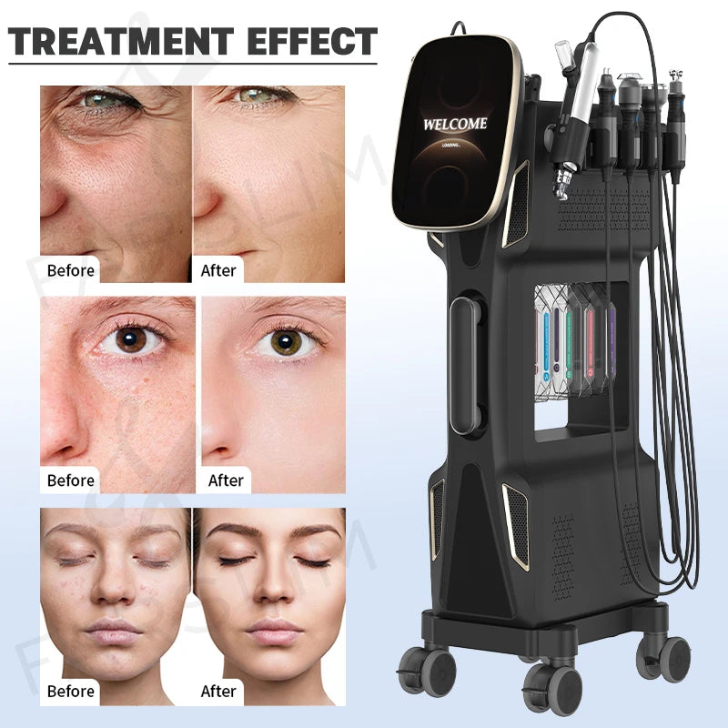 9 In 1 Hydrogen Oxygen Bubble HydroFacial Machine Water Dermabrasion DeepCleansing Skin Rejuvenation Salon